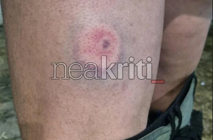 πλαστική σφαιρα