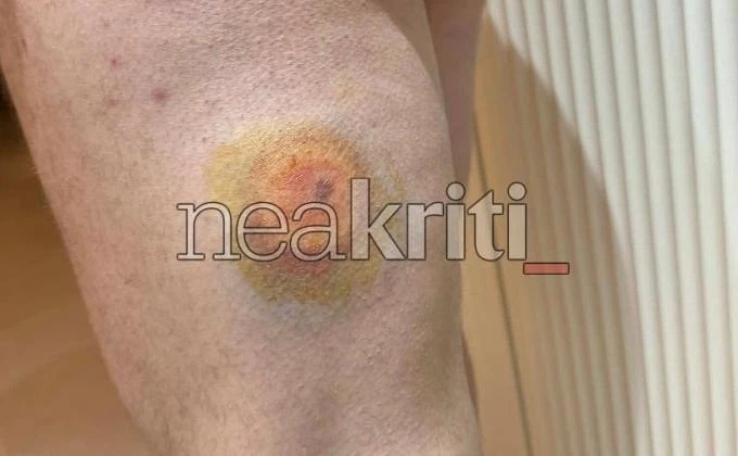 πλαστική σφαίρα