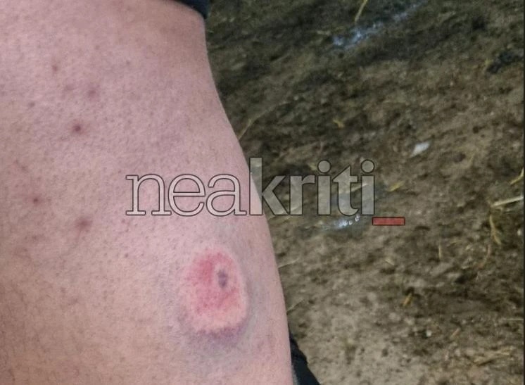 πλαστικη σφαιρα