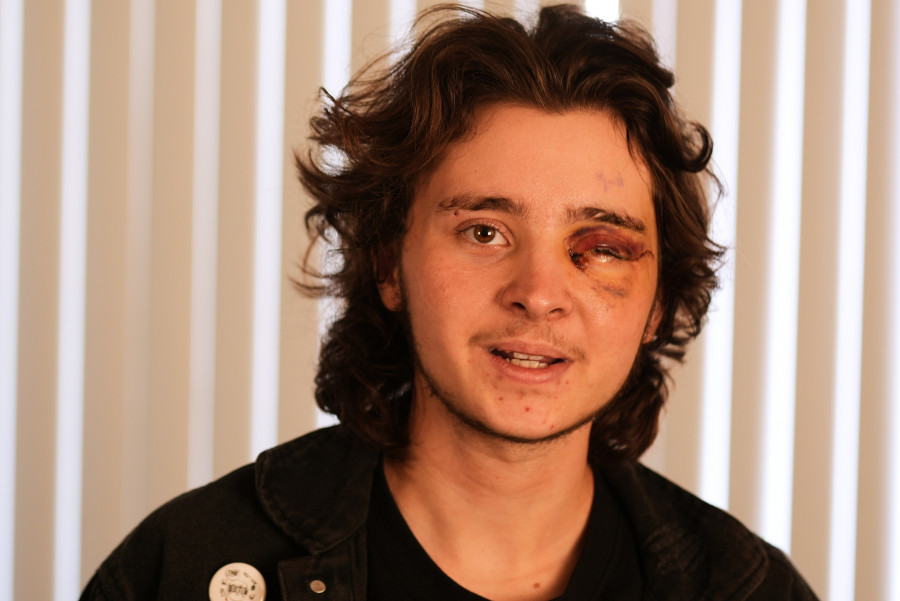 Καλιφόρνια - Τραυματισμένος διαδηλωτής