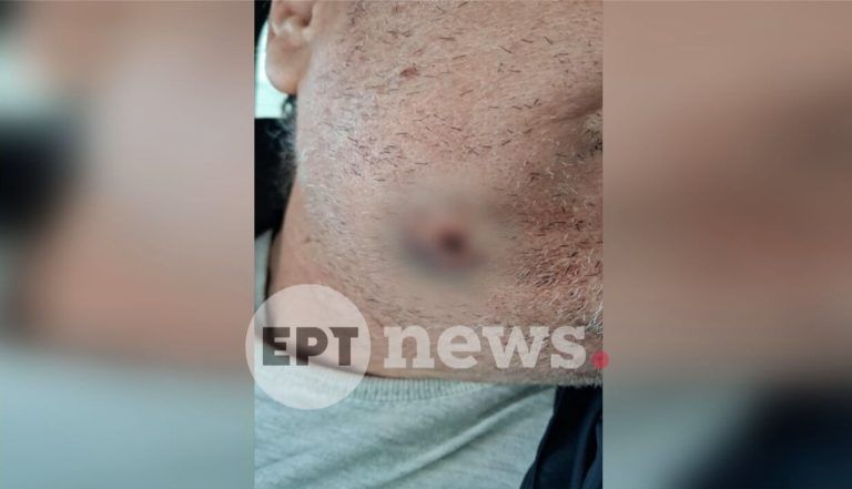 Άγρια επίθεση σε οδηγό ταξί στο Αιγάλεω: Τον μαχαίρωσαν και του πήραν το όχημα – Τι λέει ο ίδιος στο ΕΡΤnews