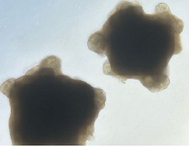 organoids.jpg