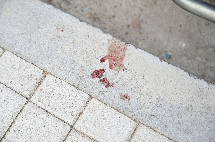 ΝΕΚΡΟΣ 20ΧΡΟΝΟΣ ΜΕΤΑ ΑΠΟ ΕΠΙΘΕΣΗ ΜΕ ΜΑΧΑΙΡΙ ΣΤΗ ΘΕΣΣΑΛΟΝΙΚΗ