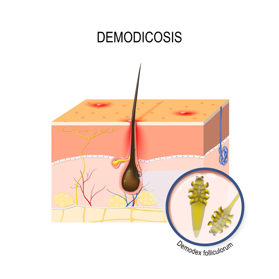 demodicosis ακαρεα