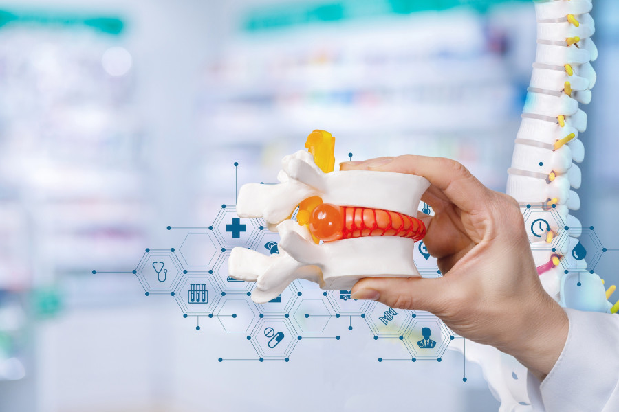 κηλη μεσοσπονδηλιου δισκου σπονδυλικη στηλη