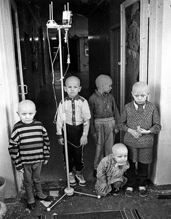 Τσερνόμπιλ - παιδιά - επιπτώσεις