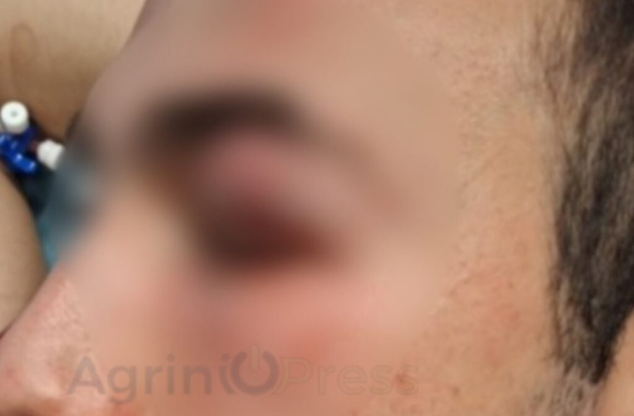 1778064068703-266872306-epeisodio-1024x673.jpg