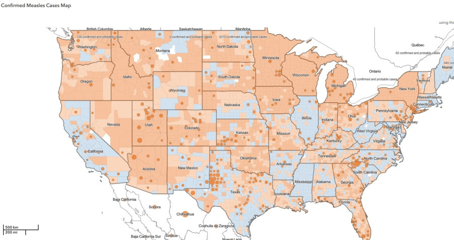 measles-us.jpg
