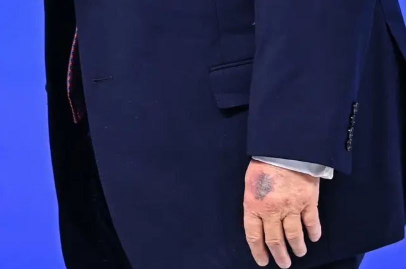 g.jpg