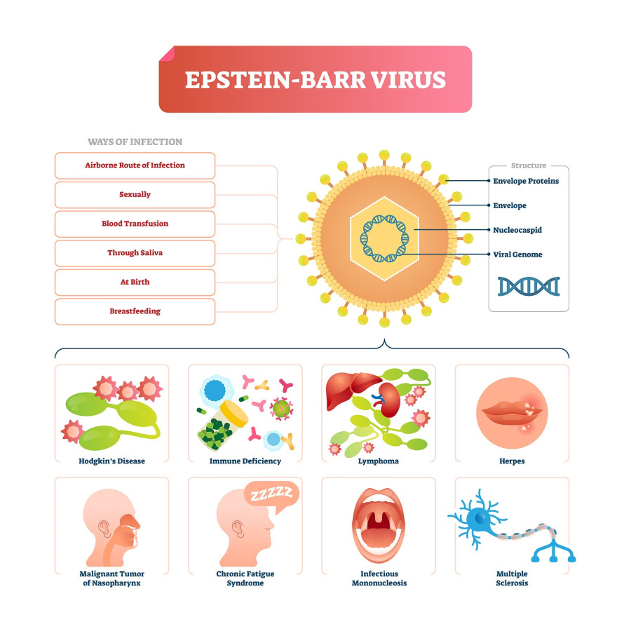 Παθησεις που συνδεονται με τον ιο Epstein Barr