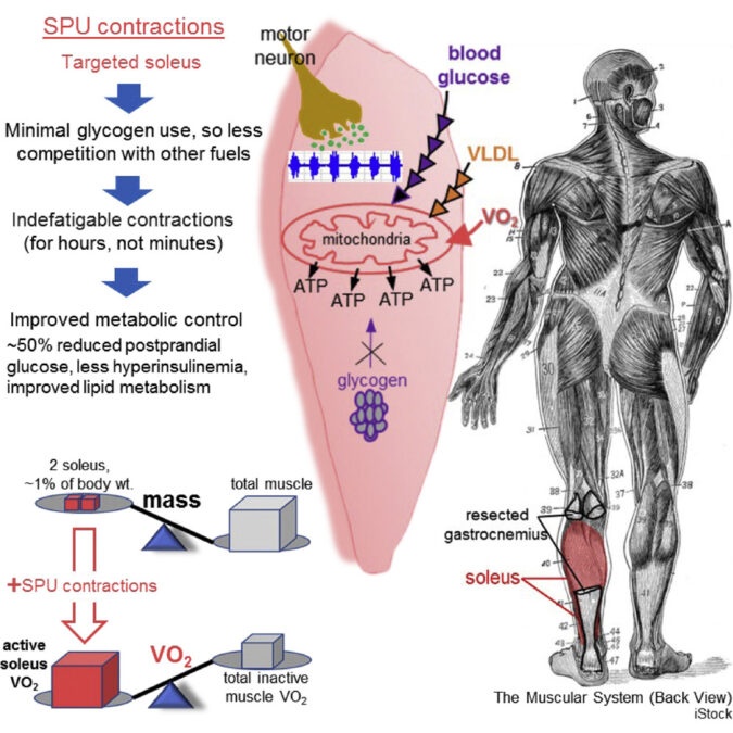 soleuspushupconstractions-675x675.jpg