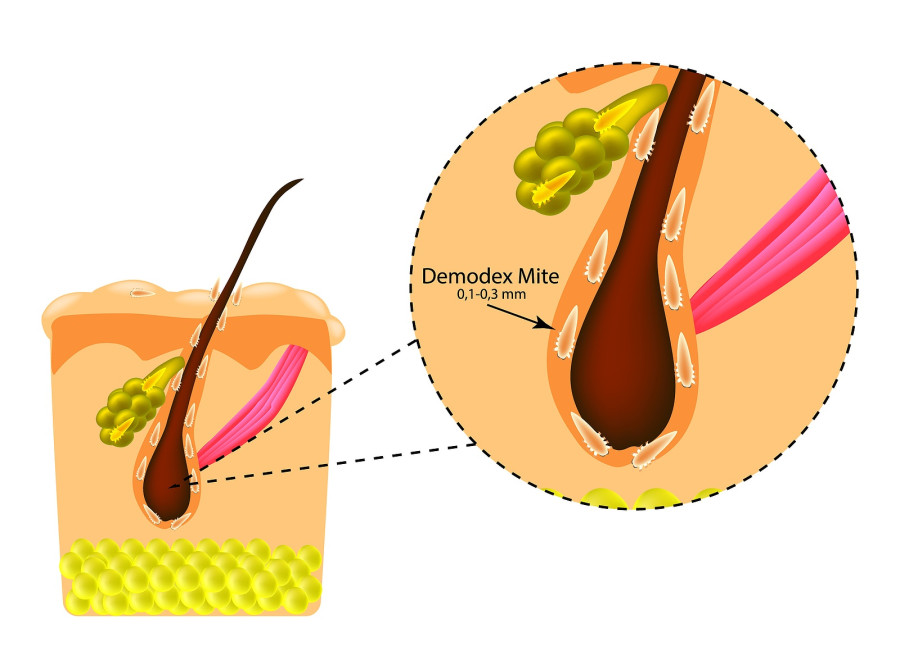 ακαρεα demodex στις βλεφαριδες