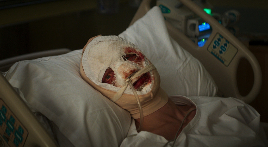 clayface-injury.jpeg