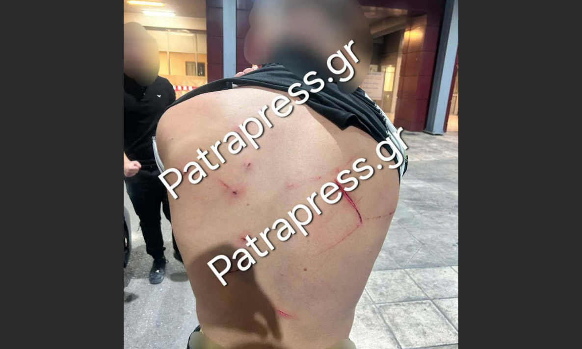 Ρίο: Χτύπησαν 18χρονο με κατσαβίδι 13 φορές και πήγαν να τον πετάξουν στη θάλασσα - Εικόνα