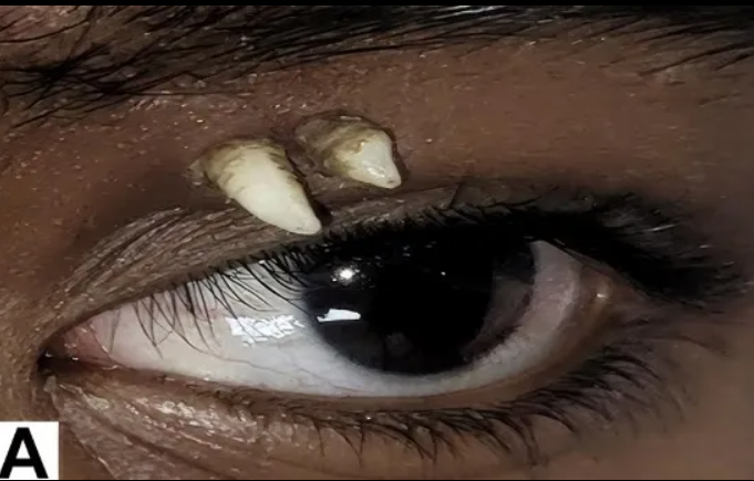 tooth.png