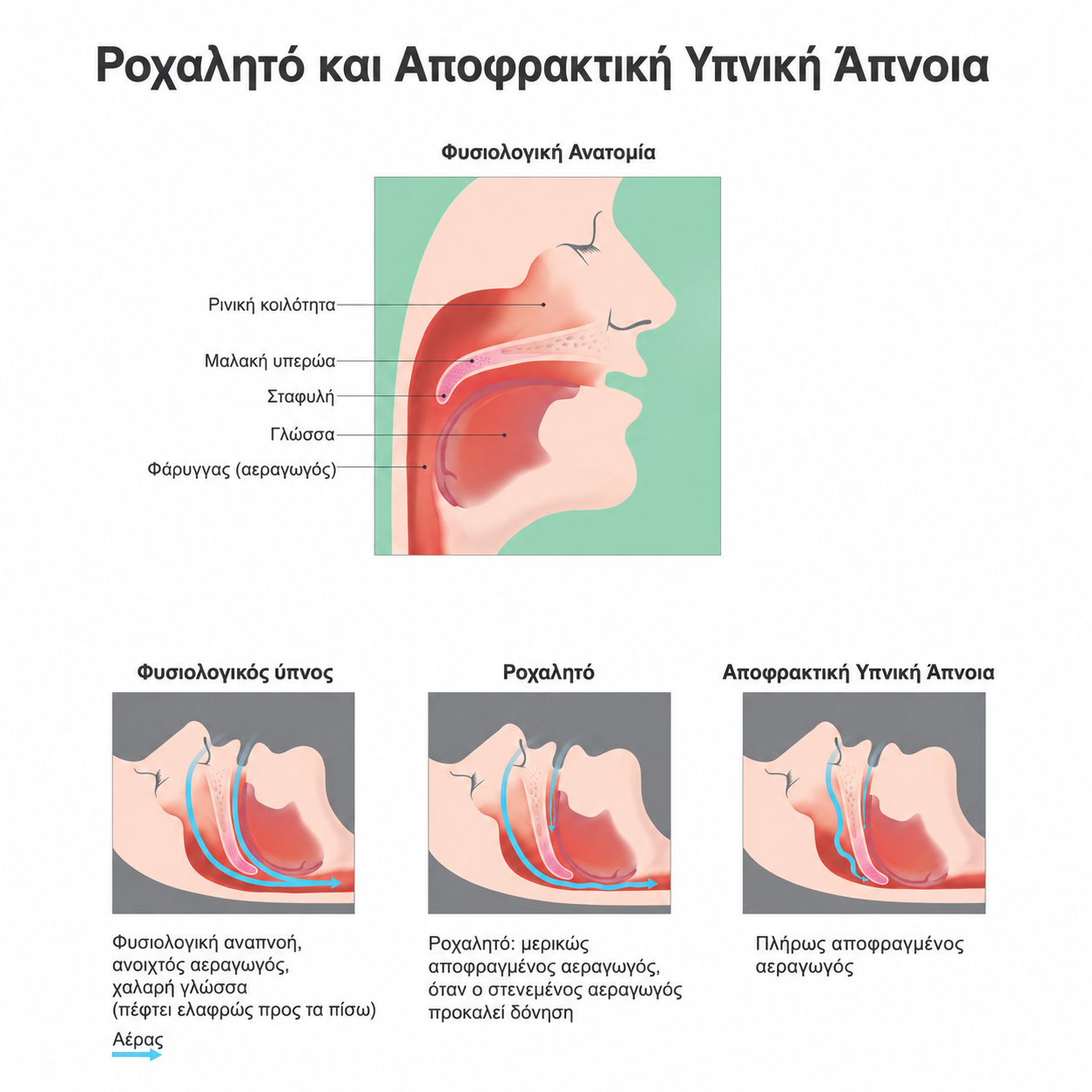 ροχαλητο και αποφρακτικη υπνικη απνοια