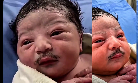 Το μωρό με το «μουστάκι»: Το viral βίντεο που κάνει θραύση στο διαδίκτυο